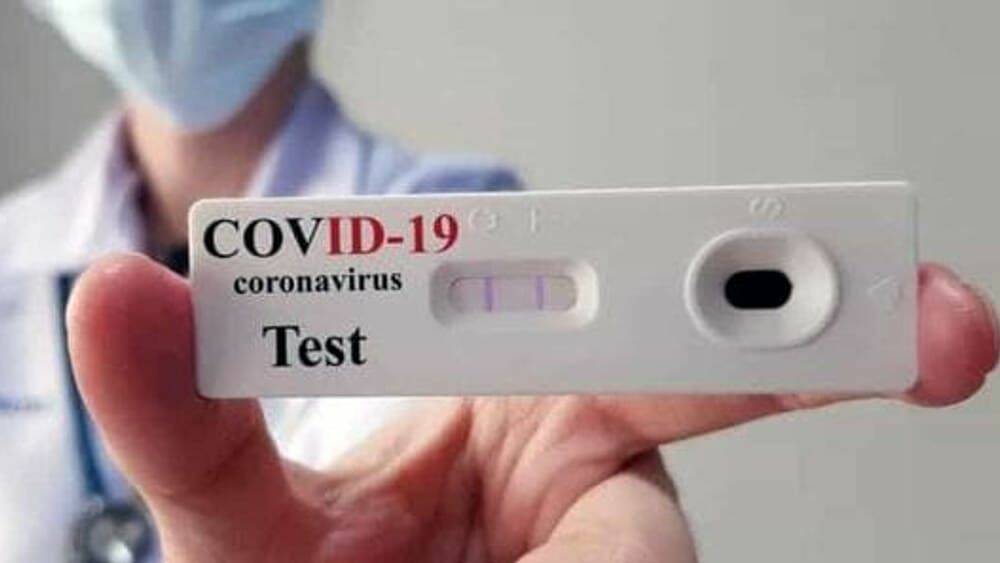 test sierologico coronavirus-2