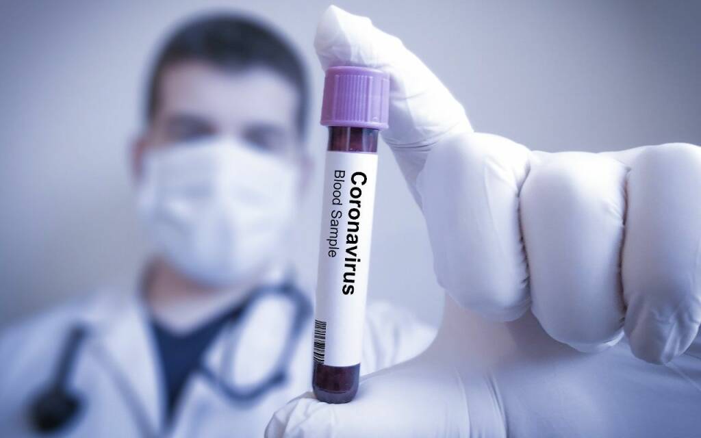 Coronavirus (12)
