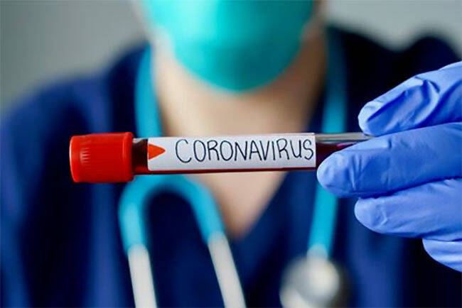 Coronavirus (6)