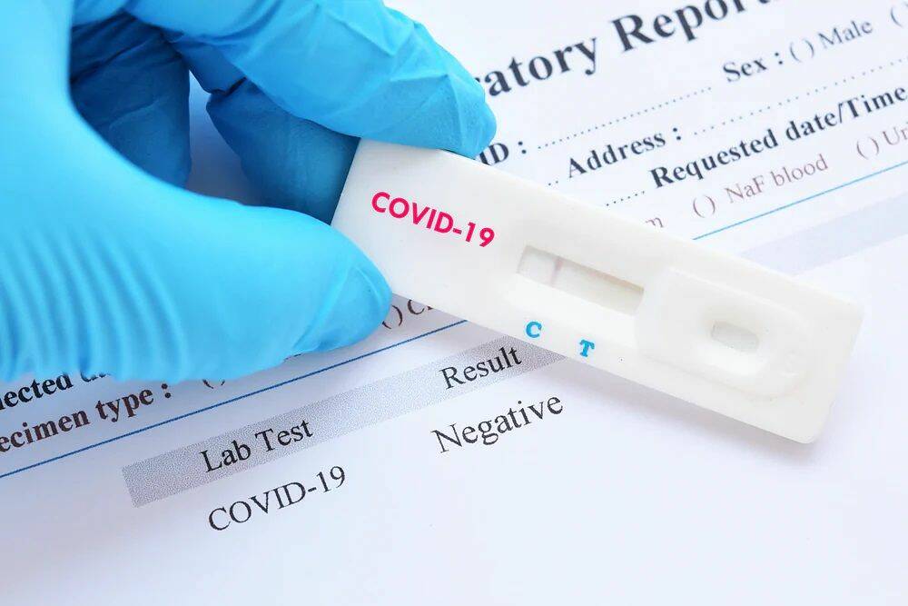 coronavirus NEGATIVO