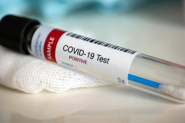 coronavirus POSITIVO