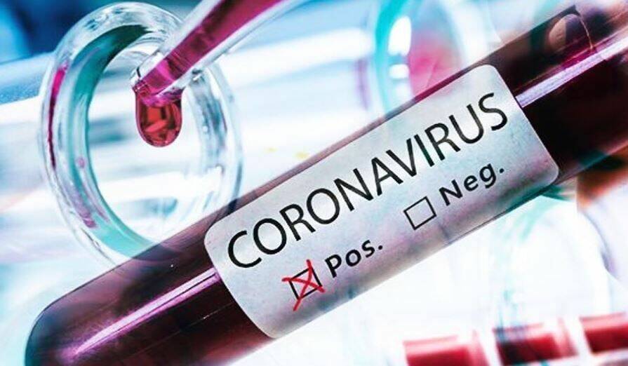 coronavirus 11